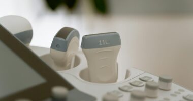 A detailed view of medical ultrasound equipment in a healthcare facility.