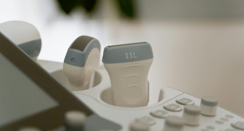 A detailed view of medical ultrasound equipment in a healthcare facility.